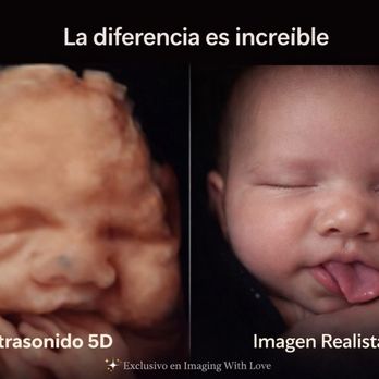 Imaging With Love - Conoce a tu bebé en 3D / 4D / 5D Video Realista 8K incluido Imaging With Love - Miami 305-646-8096 - Ultrasound Imaging Centers Near Me - Miami, Florida Imaging With Love - Conoce a tu bebé en 3D / 4D / 5D Video Realista 8K incluido Imaging With Love - Miami 305-646-8096 - Ultrasound Imaging Centers Near Me - Miami, Florida