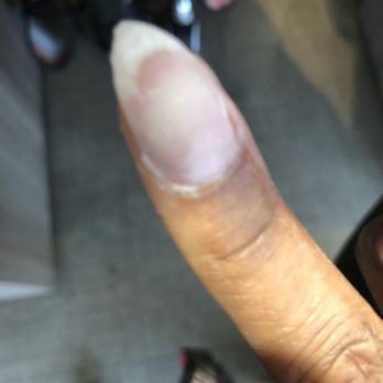 Vip Nails And Spa - Left product on the nail before doing the new over lay - Nail Salons Near Me - Humble, Texas Vip Nails And Spa - Left product on the nail before doing the new over lay - Nail Salons Near Me - Humble, Texas