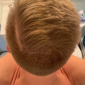 Flawless Cuts by Alexander - Day after no product, no evidence of colic. Part all the way back and straight. - Barbers Near Me - Levittown, Pennsylvania Flawless Cuts by Alexander - Day after no product, no evidence of colic. Part all the way back and straight. - Barbers Near Me - Levittown, Pennsylvania