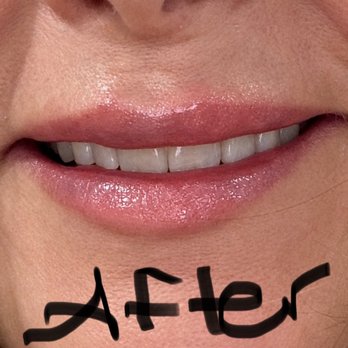 Injector Kaity - Medical Spas Near Me - Scottsdale, Arizona Injector Kaity - Medical Spas Near Me - Scottsdale, Arizona
