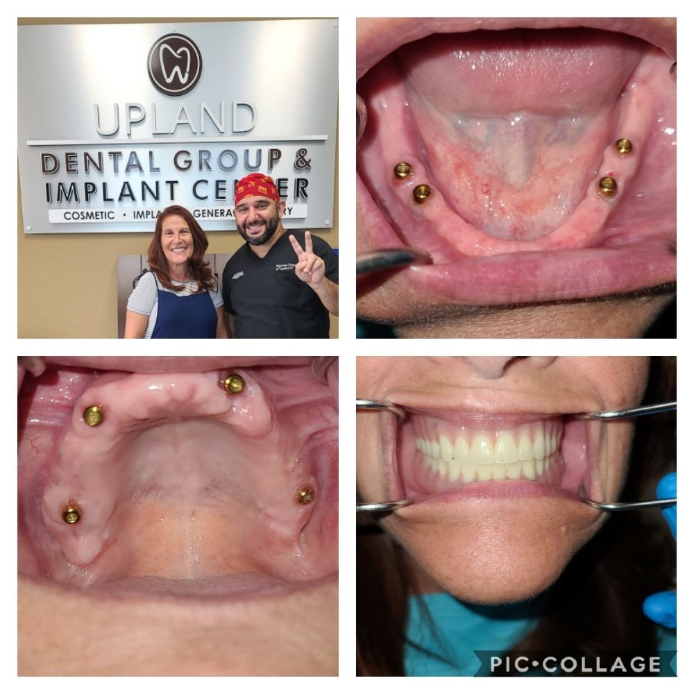 UPLAND DENTAL GROUP AND IMPLANT CENTER 96 Photos & 112 Reviews