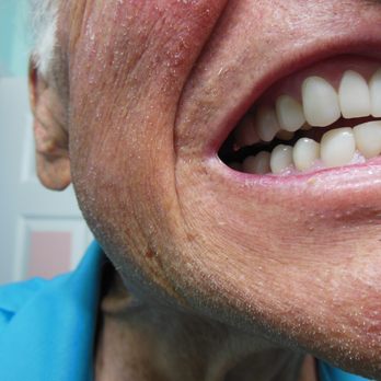 Castle Dental - Cosmetic Dentists Near Me - Vicente Guerrero, BCN Castle Dental - Cosmetic Dentists Near Me - Vicente Guerrero, BCN