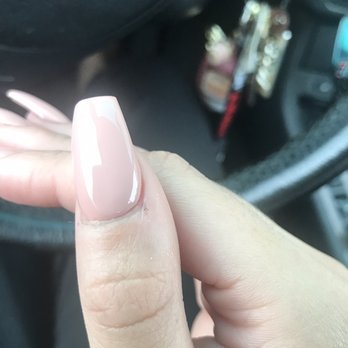 Coco Nail Spa - Burnt skin from over sanding - Nail Salons Near Me - Houston, Texas