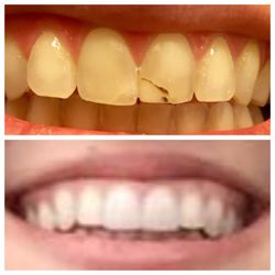 Joseph Elmassian, DDS