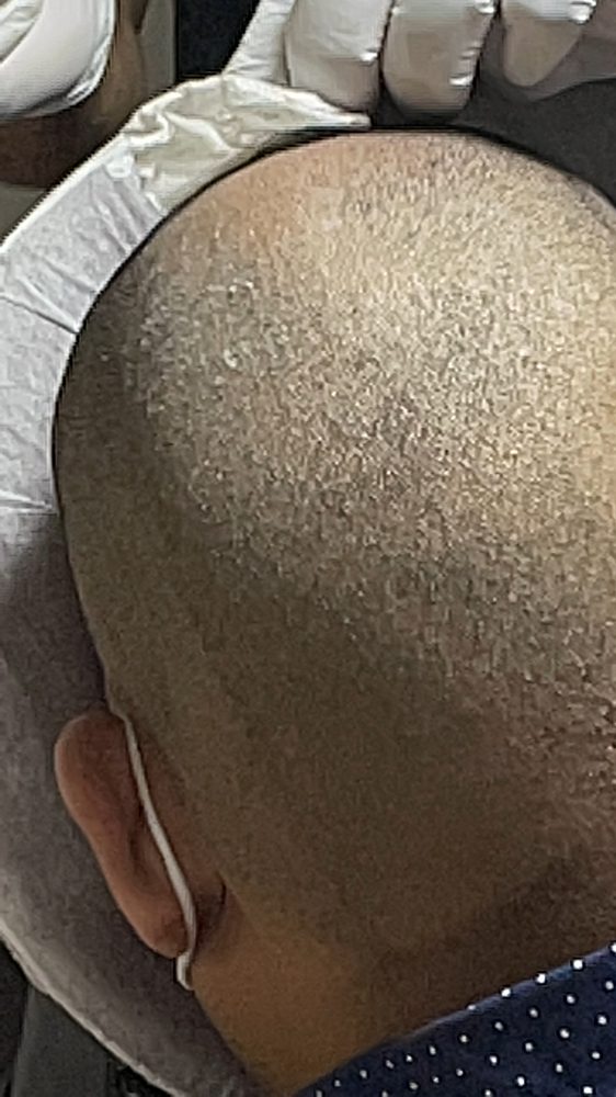 PASADENA WOMEN AND MEN’S SCALP MICRO PIGMENTATION Updated October