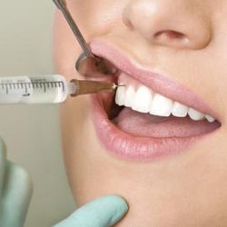 Dental Center Of Merrifield - We use anesthesia to help make your appointments comfortable