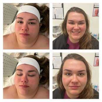 Bellissimo Spa - Body Contouring Near Me - Fredonia, New York