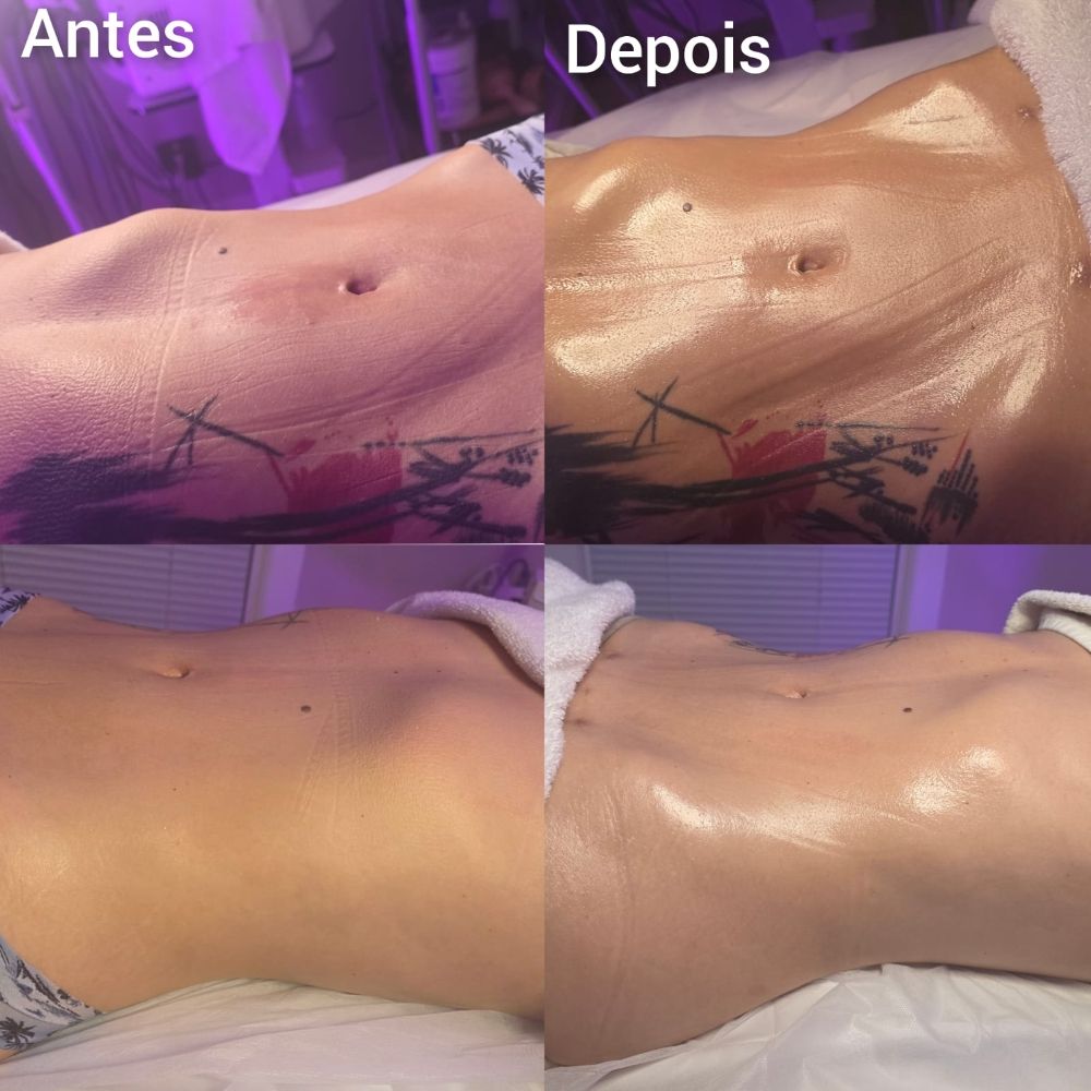 Brazilian Body Sculpting Logo