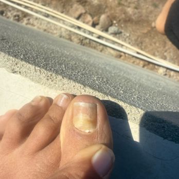 Powder Beauty - One month after. - Nail Salons Near Me - Los Angeles, California