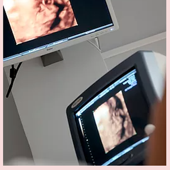 Reflections From Conception - Ultrasound Imaging Centers Near Me - Phoenix, Arizona Reflections From Conception - Ultrasound Imaging Centers Near Me - Phoenix, Arizona