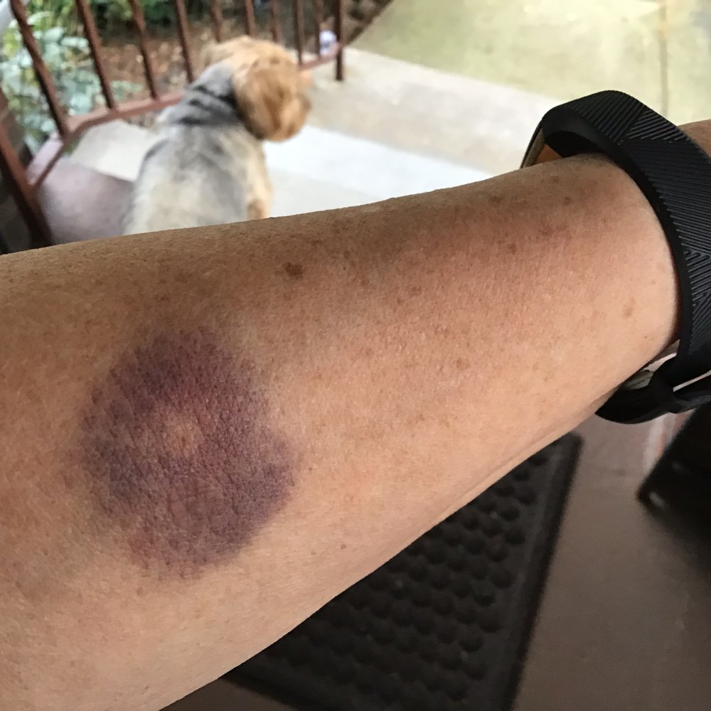 BARIATRICS WORKS Updated October 2024 4325 Murray Ave, Pittsburgh