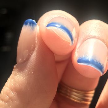 Pinks Nail Spa - Here you can see one of the bubbles underneath the acrylics (thumb), and what the underneath of the manicure looked like. - Nail Salons Near Me - Los Angeles, California
