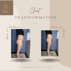 Embodyment Sculpting - Laser Lipo - Treating the mid section area (6 treatments).