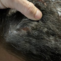 J R Hair & Nails - Burnt scalp