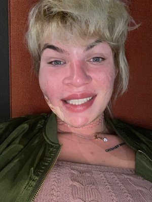 BEVERLY HILLS TRANSGENDER SURGERY: DR. ALEXANDER SINCLAIR - Updated ...