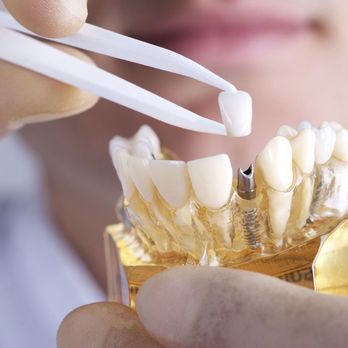 Rockwall Family Dentistry - Rockwall Family Dentistry | Rockwall, TX - Cosmetic Dentists Near Me - Rockwall, Texas Rockwall Family Dentistry - Rockwall Family Dentistry | Rockwall, TX - Cosmetic Dentists Near Me - Rockwall, Texas