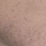 Photo of Advanced Skin Care & Hair Removal Center
