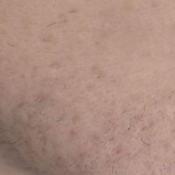 Advanced Skin Care & Hair Removal Center