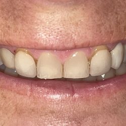 West Villages Dental Care - Before