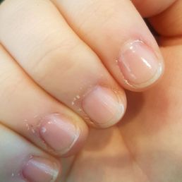 4 days after a manicure at this place- this is after 4 days of bathing my hands in various oils and medicated creams (for burning cuticles). 4 days after a manicure at this place- this is after 4 days of bathing my hands in various oils and medicated creams (for burning cuticles).