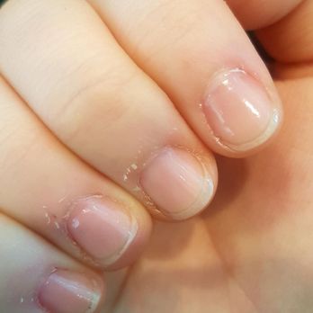 Organic Nail Bar - 4 days after a manicure at this place- this is after 4 days of bathing my hands in various oils and medicated creams (for burning cuticles). - Nail Salons Near Me - Toronto, Ontario Organic Nail Bar - 4 days after a manicure at this place- this is after 4 days of bathing my hands in various oils and medicated creams (for burning cuticles). - Nail Salons Near Me - Toronto, Ontario