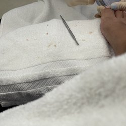 Final Touch - You can see how many times she cut me by the old skin and you can see a darker OLD blood stain on towel.
