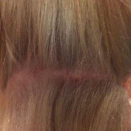 Burned scalp! Thanks to Gabby at salon D'Artiste