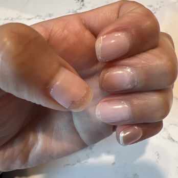 B B Nails - 4 days after their repair - A hand with light pink nail polish shows chipped and peeling nails, resting on a white marble surface. - Nail Salons Near Me - Saline, Michigan