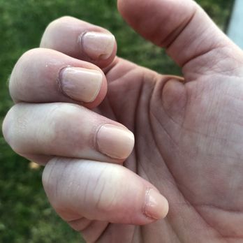 Sky Nails - Five days after my basic manicure - Nail Salons Near Me - Rocklin, California Sky Nails - Five days after my basic manicure - Nail Salons Near Me - Rocklin, California