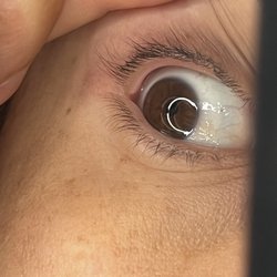 Ocean Eyebrow Threading - Both eyes were missing eyelashes!