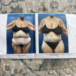 Left is before and right is after Left is before and right is after