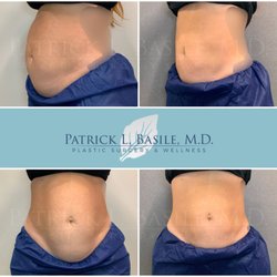 Patrick L Basile, MD - Plastic Surgery & Wellness