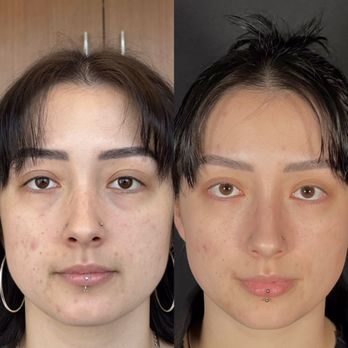 RIVKIN Aesthetics - Before and After - Cosmetic Surgeons Near Me - Los Angeles, California RIVKIN Aesthetics - Before and After - Cosmetic Surgeons Near Me - Los Angeles, California
