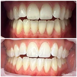 Smile Hy NV LLC - Before and after.