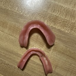 New dentures compared to old teeth