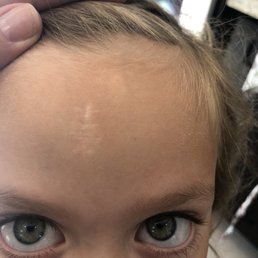 Scar