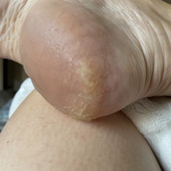 St George Day Spa - Heels not even touched! - Day Spas Near Me - Saint George, Utah St George Day Spa - Heels not even touched! - Day Spas Near Me - Saint George, Utah