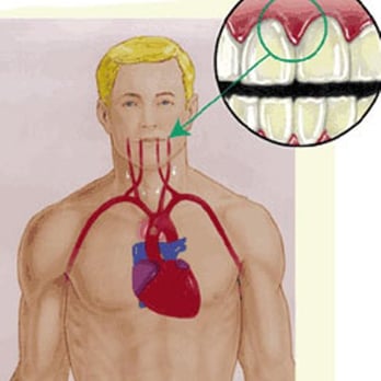 David Scharf - Long Island Periodontics & Dental Implants - emergency dental service babylon ny - Periodontists Near Me - Babylon, New York David Scharf - Long Island Periodontics & Dental Implants - emergency dental service babylon ny - Periodontists Near Me - Babylon, New York