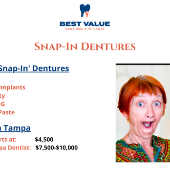 Best Value Dentures and Implants Near Me - Cosmetic Dentists Near Me - Tampa, Florida