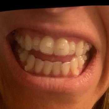 GO Orthodontics - Columbus MS - Orthodontists Near Me - Columbus, Mississippi GO Orthodontics - Columbus MS - Orthodontists Near Me - Columbus, Mississippi