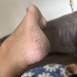 Nailogy Lab - I asked for callus they buffed my feet? Left them like this.