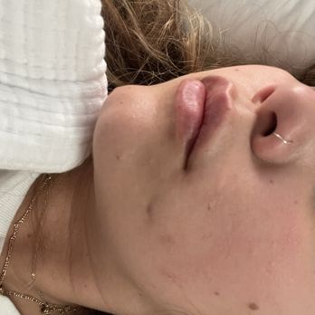 Macro Med - Side profile - Medical Spas Near Me - Corona, California