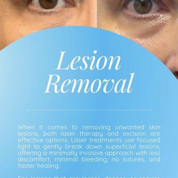 Oculofacial Plastic Surgery Hawaii - Instagram story photo they used is misleading as this was taken before wound fully healed & scar formed - Cosmetic Surgeons Near Me - Honolulu, Hawaii