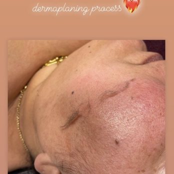THE SKN LOUNGE - Dermaplaning - Eyelash Service Near Me - Birmingham, Michigan THE SKN LOUNGE - Dermaplaning - Eyelash Service Near Me - Birmingham, Michigan