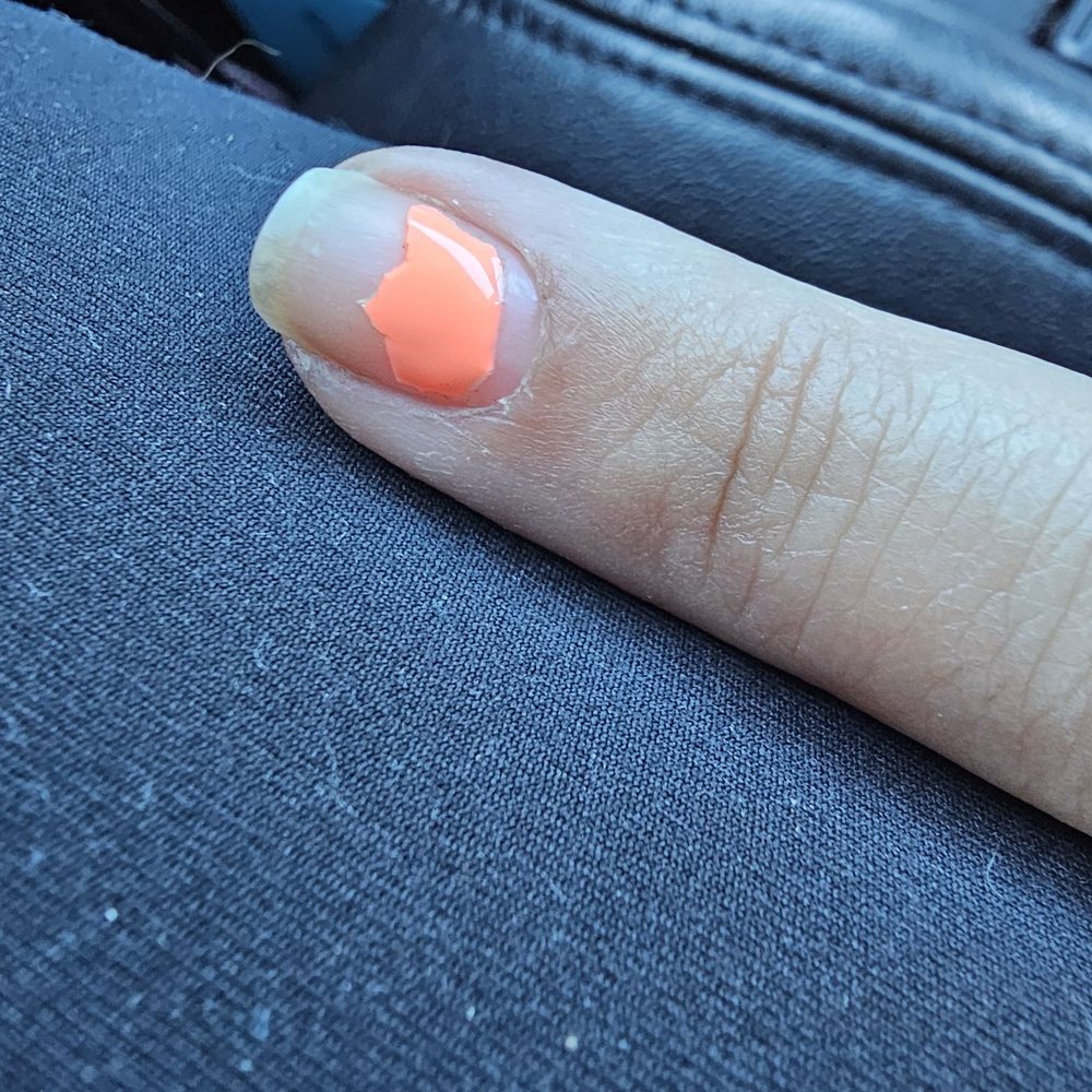 Amazing Nails & Spa - Lifted and peeled off from top. Not even a full week. - Nail Salons Near Me - Turlock, California
