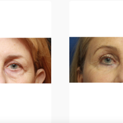 Moy, Fincher, Chipps Facial Plastics & Dermatology