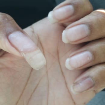 Unique Nails Tacoma - They butchered my nails. After I repeated twice TAKE OFF OVERLAY, CUT DOWN, AND A NEW OVERLAY. - Nail Salons Near Me - Tacoma, Washington