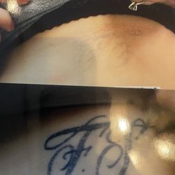 Before and after- 3 treatments