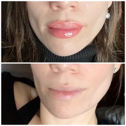 Before and immediately after lip blushing Before and immediately after lip blushing