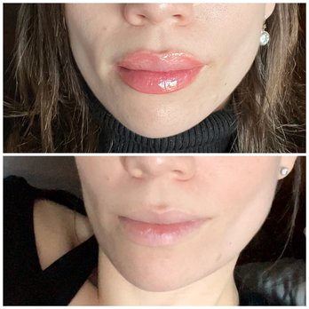Beauty Fx Ink - Before and immediately after lip blushing - Eyelash Service Near Me - Los Angeles, California Beauty Fx Ink - Before and immediately after lip blushing - Eyelash Service Near Me - Los Angeles, California
